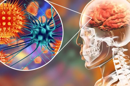 Koji su simptomi, kako se širi i kako se liječi meningitis B?