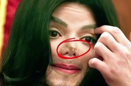 Zašto je Michael Jackson zapravo nosio traku na nosu?