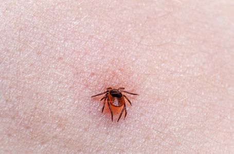 Jedan predmet može vas spasiti od krpelja: Sve što trebate jest staviti ga u džep