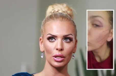 Skandal trese region: Ava Karabatić nakon nasilja otkrila šokantne detalje