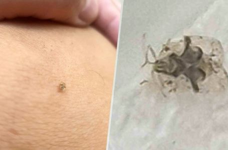 Uzbuna u Hrvatskoj zbog najezde invazivnih stjenica: Dokazano da mogu sisati ljudsku krv