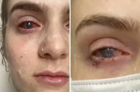 Popila tabletu protiv bolova koju uzimaju mnogi, a onda joj se život zauvijek promijenio
