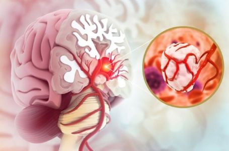 3 simptoma raka koji se javljaju ujutru: Upozoravaju na metastaze, a evo šta odmah treba uraditi